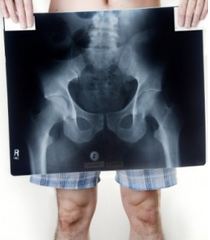 Are you suffering from pelvic floor dysfunction? X-ray of a mans pelvis, to illustrate area of disorderAre you suffering from pelvic floor dysfunction?