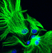 Green glial fibrillary acidic proteins in a mouse astrocyte.