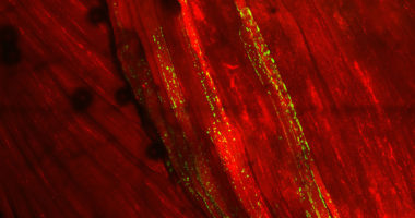 Red Muscle Fibers with TDP-43 Clumping in Green
