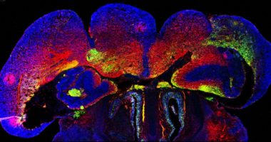 A mutated Arl13b gene caused neurons (red