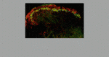 The results were published online in the Journal of Pain.