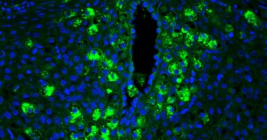 Hormonal signals from a developing fetus help recruit special cells (shown here in green) that enlarge the mother’s blood vessels (black area)