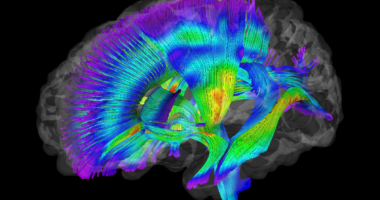 Image of white matter pathways extracted from diffusion tensor imaging data for infants at-risk for autism. Warmer colors represent higher fractional anisotropy. Image created by Jason Wolff