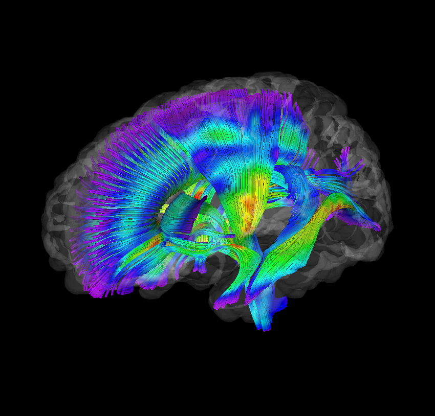 Image of white matter pathways extracted from diffusion tensor imaging data for infants at-risk for autism. Warmer colors represent higher fractional anisotropy. Image created by Jason Wolff