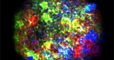 Damaged chromosomes in Atr-mutant progenitors.