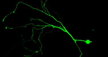 A fluorescently labeled neuron in which the apoptosis pathway is inhibited. Image source: Deshmukh lab
