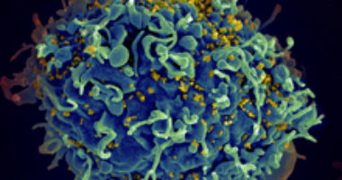 HIV particle infecting human T cell. Image source: NIAID