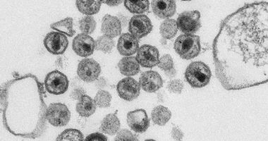 Electron micrograph of HIV virions. Credit: CDC Public Health Image Library