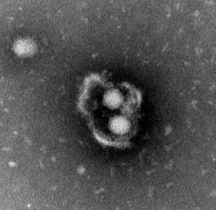 Hepatitis A Virus Cloaks Itself Inside Infected Cell Membranes Unc Health Talk Hepatitis A Virus Cloaks Itself Inside Infected Cell Membranes Unc Health Talk
