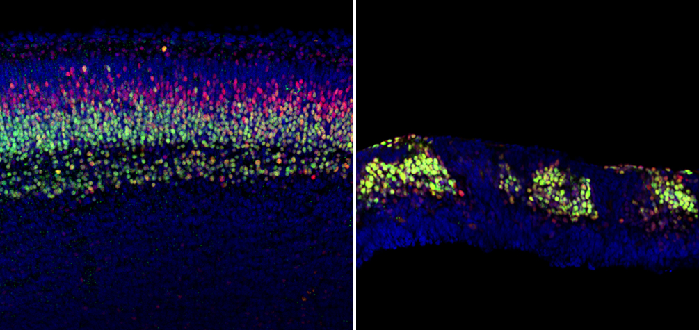 left image showstypical brain cell organization in control mice, right image shows neuron generation and migration after deleting APC protein.