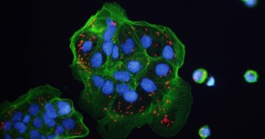 Shown in red are bacteria that have invaded host cells and escaped into the interior cytosolic compartment of the cell. Credit: Miao lab