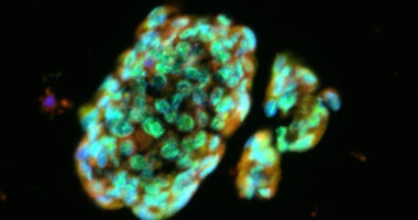 Lung Spheroid Cells