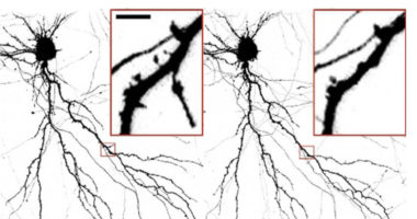 Neuron Damage