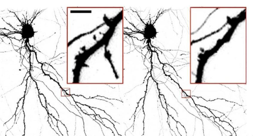 Neuron Damage
