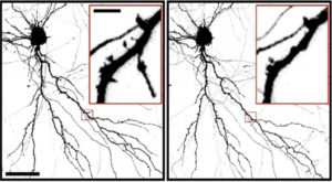 Image shows neurons before and after brain injury.