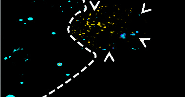 Engineered stem cells (in blue) suspended in a gel home in on a glioblastoma tumor (in yellow) in a test-tube experiment at UNC.