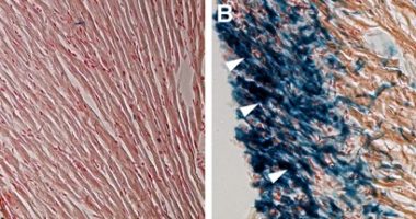 Epicardial cells (blue) form a single layer in the adult uninjured heart (panel A