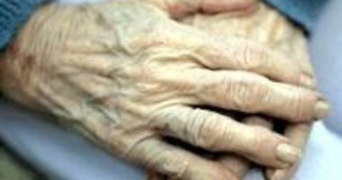 The hands of a person with arthritis. Image source: NIH.