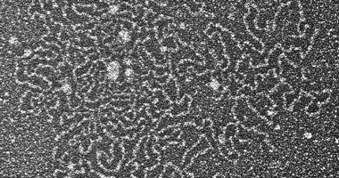 Electron microscopy of large