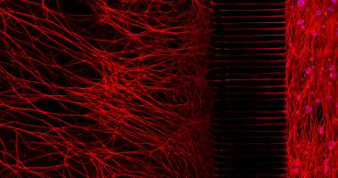 Neurons can be cultured in one compartment of a microfluidic chamber (right side) and extend their axons through very small grooves into a separate compartment (left side).