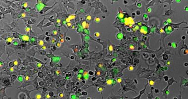 Cells infected with the KSHV virus fluoresce yellow. The KSHV virus remains dormant in more than 95 percent of infected patients. Source – UNC/Damania Lab
