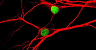 Neurons expressing the Topoisomerase-1 gene (green). Image by Angela Mabb