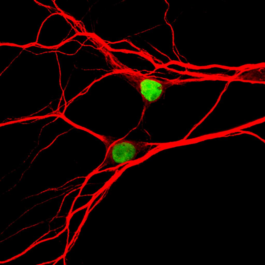 Study Pinpoints Autism Linked Protein >> Unc Pinpoints Chemo Effect On Brain Link To Autism Unc Health Talk Study Pinpoints Autism Linked Protein >> Unc Pinpoints Chemo Effect On Brain Link To Autism Unc Health Talk