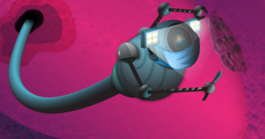 Robotic Lung