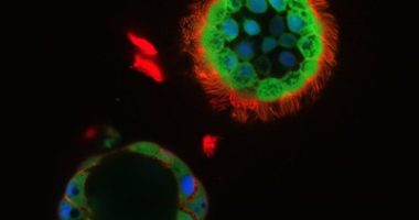 Image of nasospheroids, elements of nasal tissue used to screen for cystic fibrosis