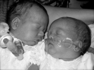 Cumbie twins shortly after birth at 26 weeks