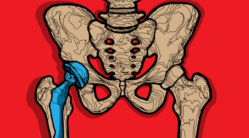 Illustration of hip bone