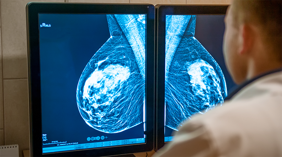 Do dense breasts affect the risk of developing breast cancer?