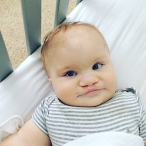 UNC pediatric patient Camden Jones, post-cleft lip and palate surgeries