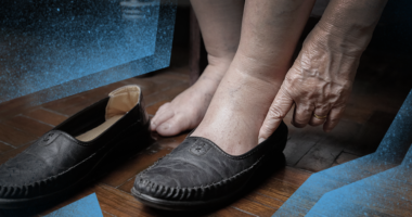 elderly person putting shoes on swollen feet