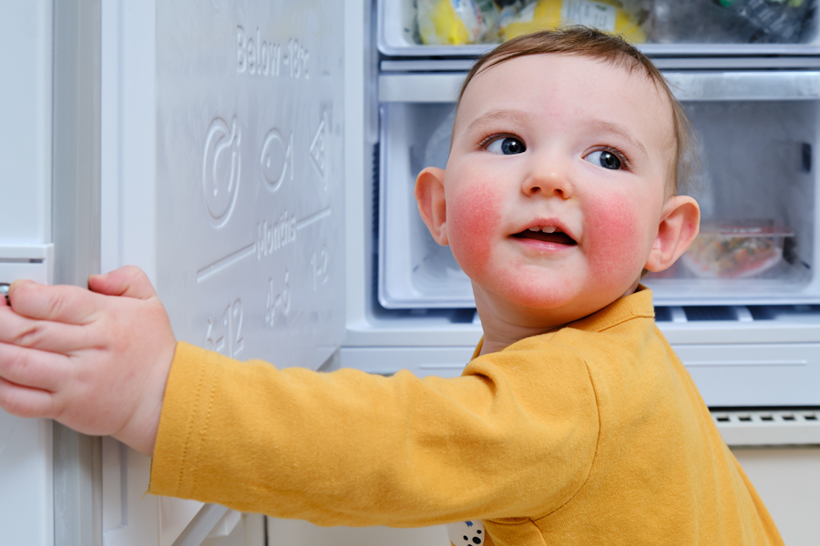 toddler boy with 5th disease rash on his cheeks