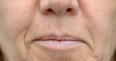 close-up picture of middle-aged woman's mouth