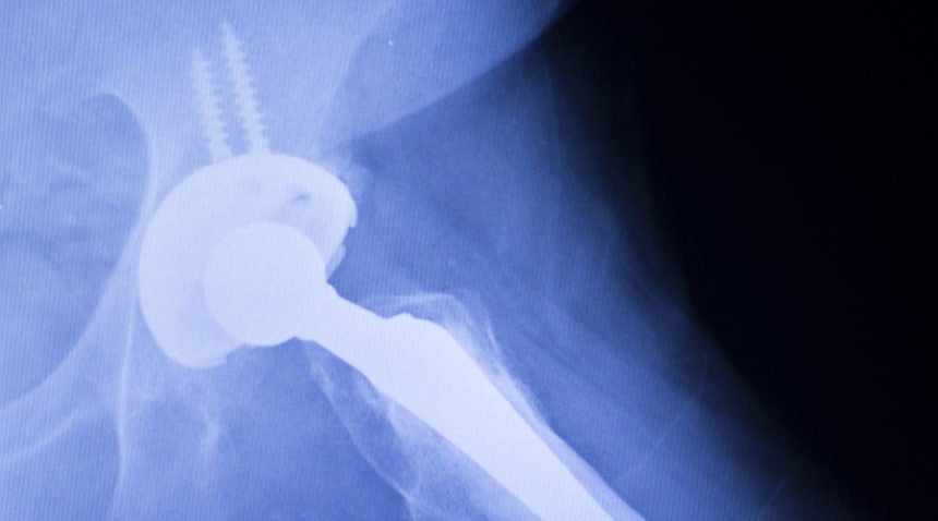 x-ray image of knee joint