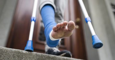 A young adult with crutches and his foot bandaged in plaster is descending the steps of a stairway outside the front door of his apartment. Barefoot toes are sticking out of bandage.