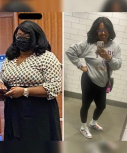 UNC Health Bariatrics patient Tiara White, side-by-side photos of her pre and post-surgery