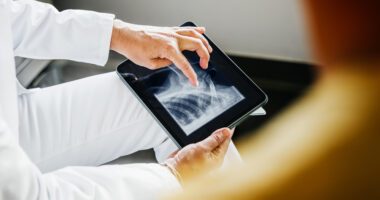 close-up view of provider looking at an x-ray on an iPad