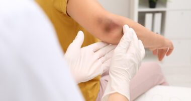 provider wearing protective gloves gently examines a bruise on a child patient's elbow