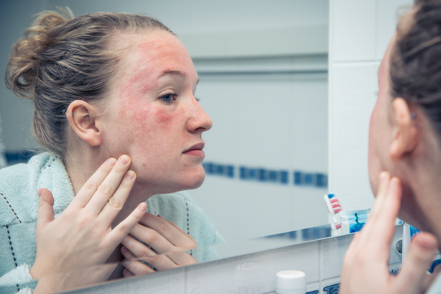 Woman examines rosacea on her face in the bathroom mirror
