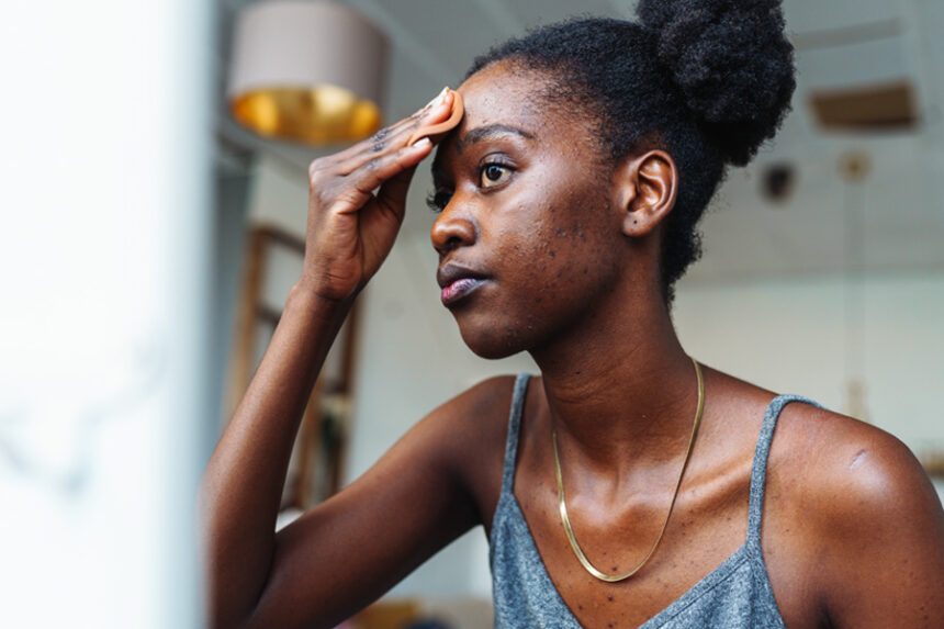 An adult examines acne on her face in the mirror