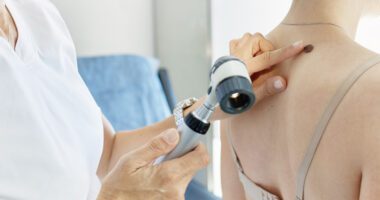 Provider points to mole on patient's back