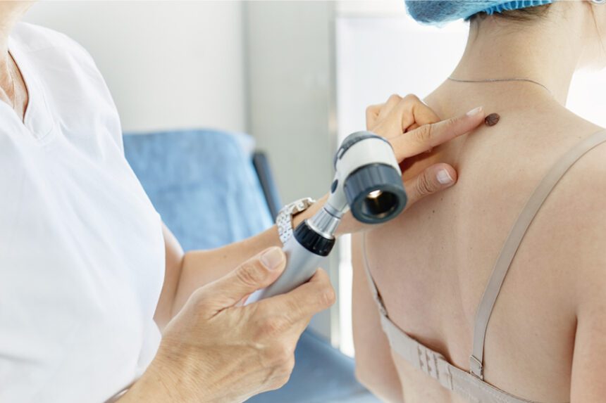 Provider points to mole on patient's back