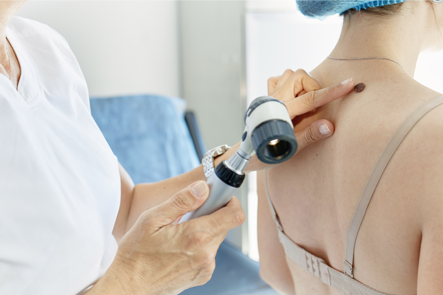 Provider points to mole on patient's back