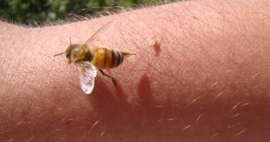 close up image of a bee stinging a person's arm