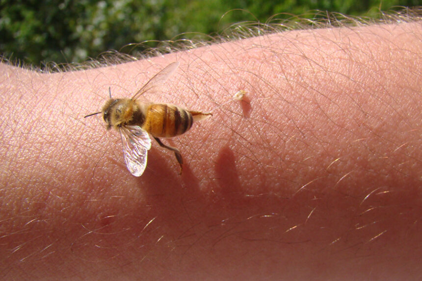 close up image of a bee stinging a person's arm