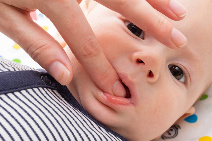 An adult gently checks a baby’s gums for signs of teething.