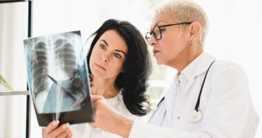 Doctor explaining a lung X-ray to a patient.